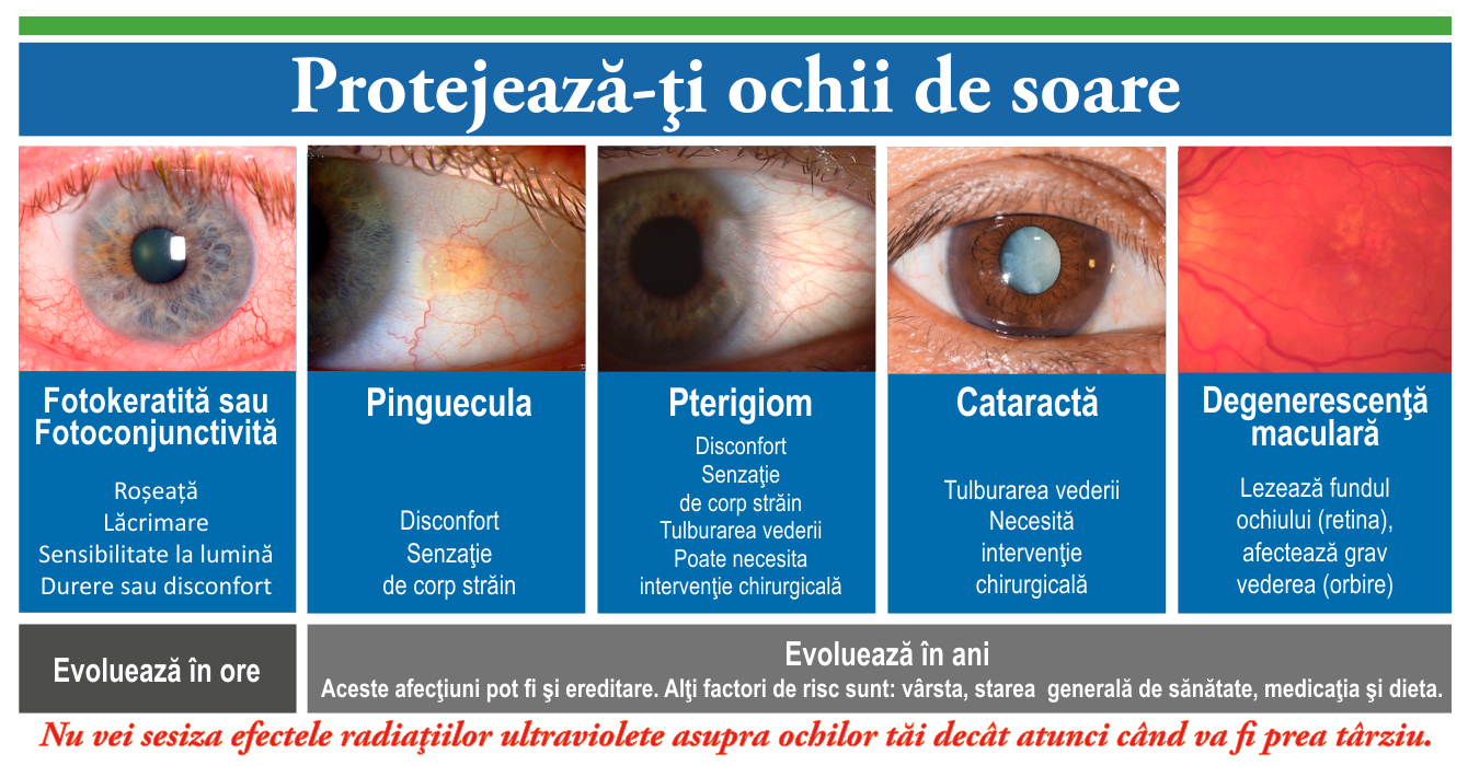 Protejeaza-ti Ochii, Optica si Lentile